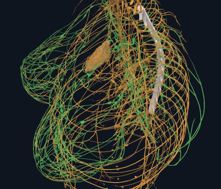 Die Anatomie des Brustkrebses